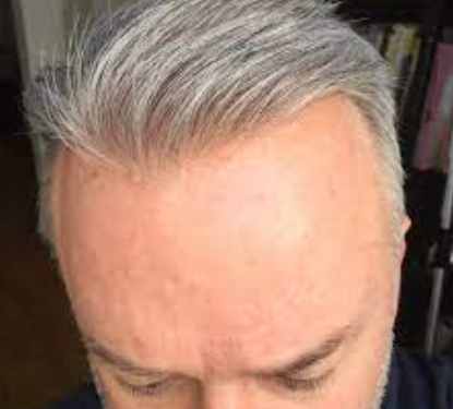 Toupee test: From a hair hat to a good match