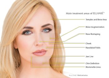 Ellanse Girl Needle Treatment for Skin Care