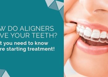 Here’s What You Need to Know About the History of Orthodontics and Clear Aligners