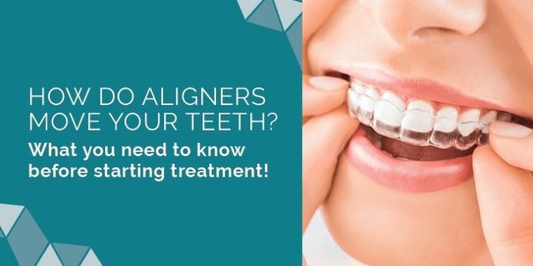 Here’s What You Need to Know About the History of Orthodontics and Clear Aligners