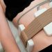 Is Non-surgical Body Contouring Replacing Liposuction?
