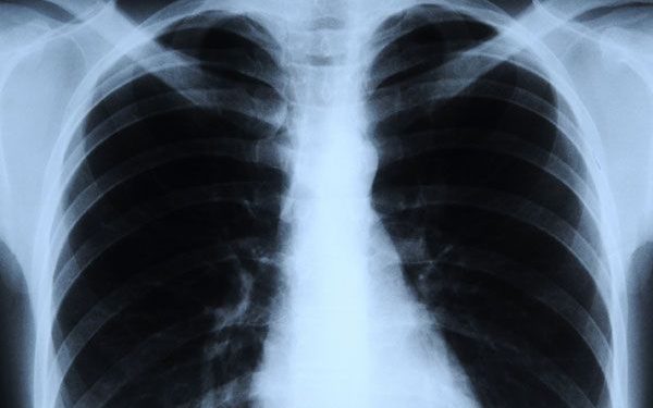 Important uses of taking X-rays