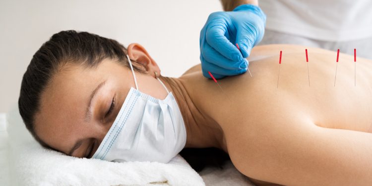 What is the goodness of acupuncture techniques for a stressed employee?