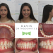 Creating Confident Smiles with Clemson Orthodontist