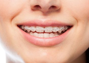Orthodontic Treatment Options For All Ages