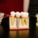 How getting dental implants in Teddington can transform your life