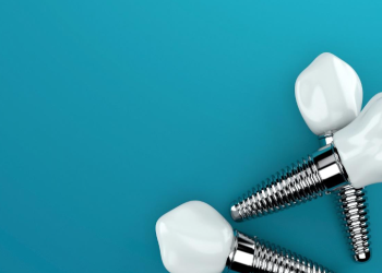 Permanent tooth replacement with dental implants Sydney