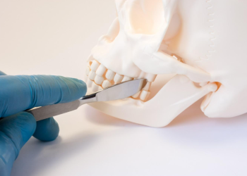 Key things orthodontic patients need to know about braces as an adult