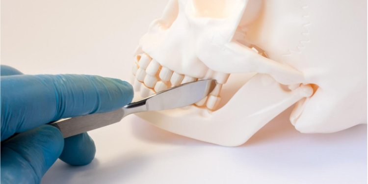 Key things orthodontic patients need to know about braces as an adult