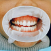 Teeth whitening Macleod for different types of stains