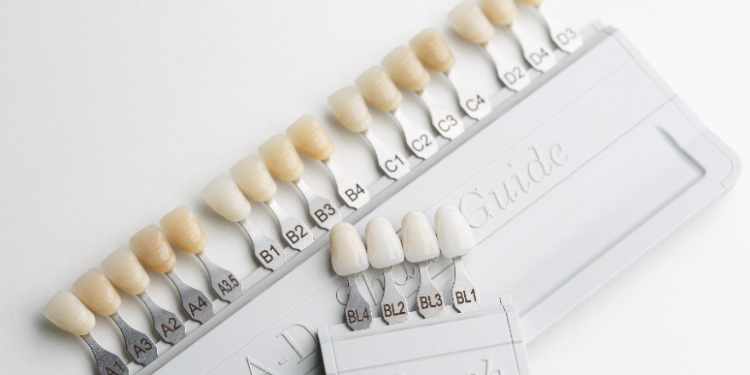 Why are veneers in London an excellent choice for smile makeovers?