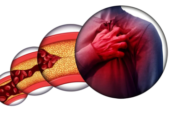 Key Signs and Symptoms of Heart Blocks to Watch For