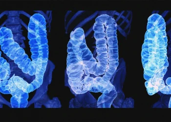 Colon Cancer: Key Facts on Causes, Risks, Symptoms, and Treatment