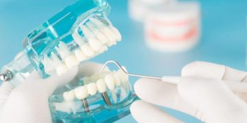 Best Dentists for Dental Implants in Mumbai: A Comprehensive Guide