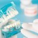 Best Dentists for Dental Implants in Mumbai: A Comprehensive Guide